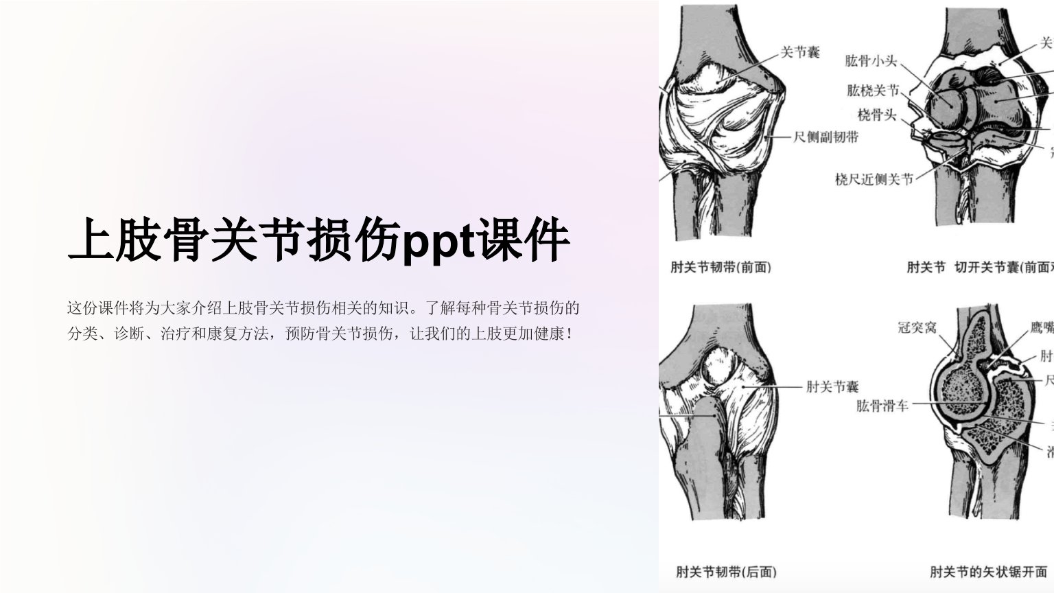 上肢骨关节损伤课件