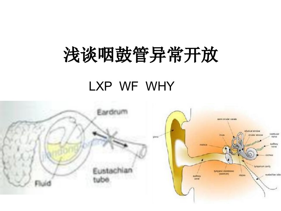 《咽鼓管异常开放》PPT课件