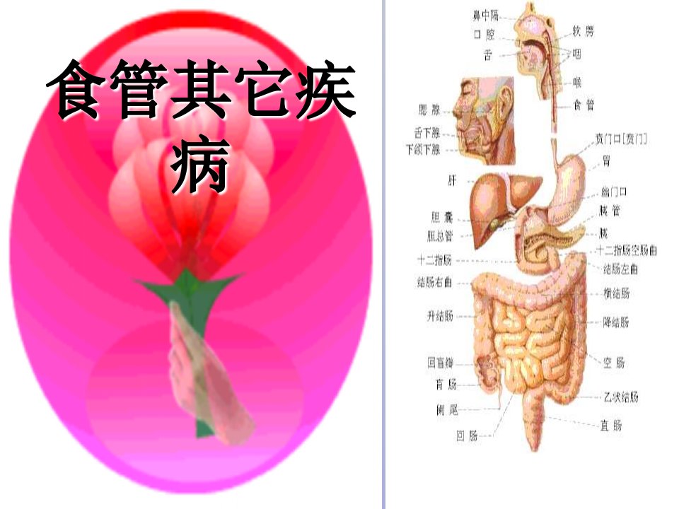 食管其它疾病