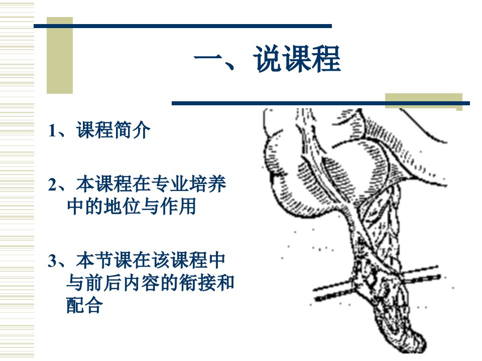 急性阑尾炎说课课件