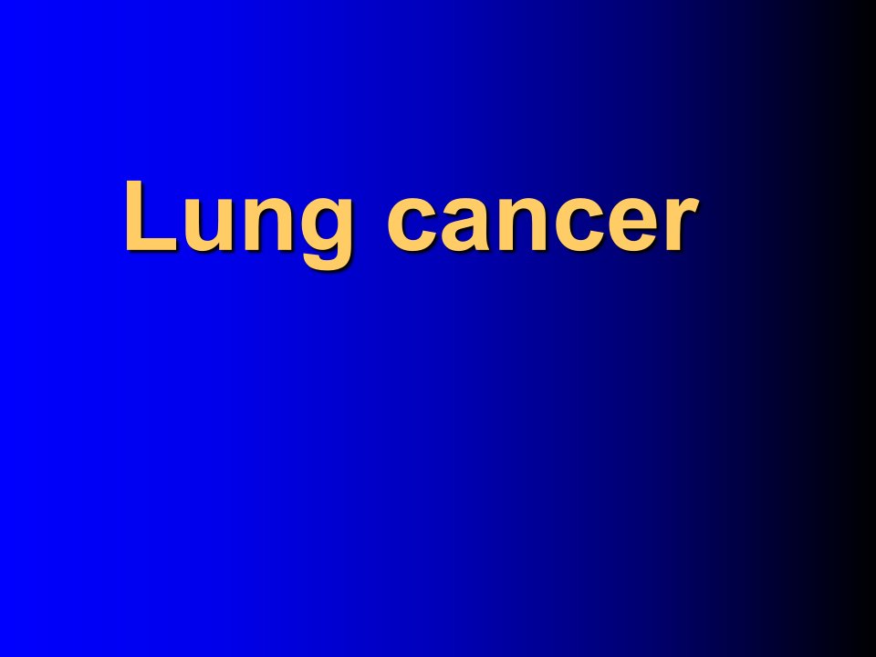 肺癌研究报告Lungcancer英文