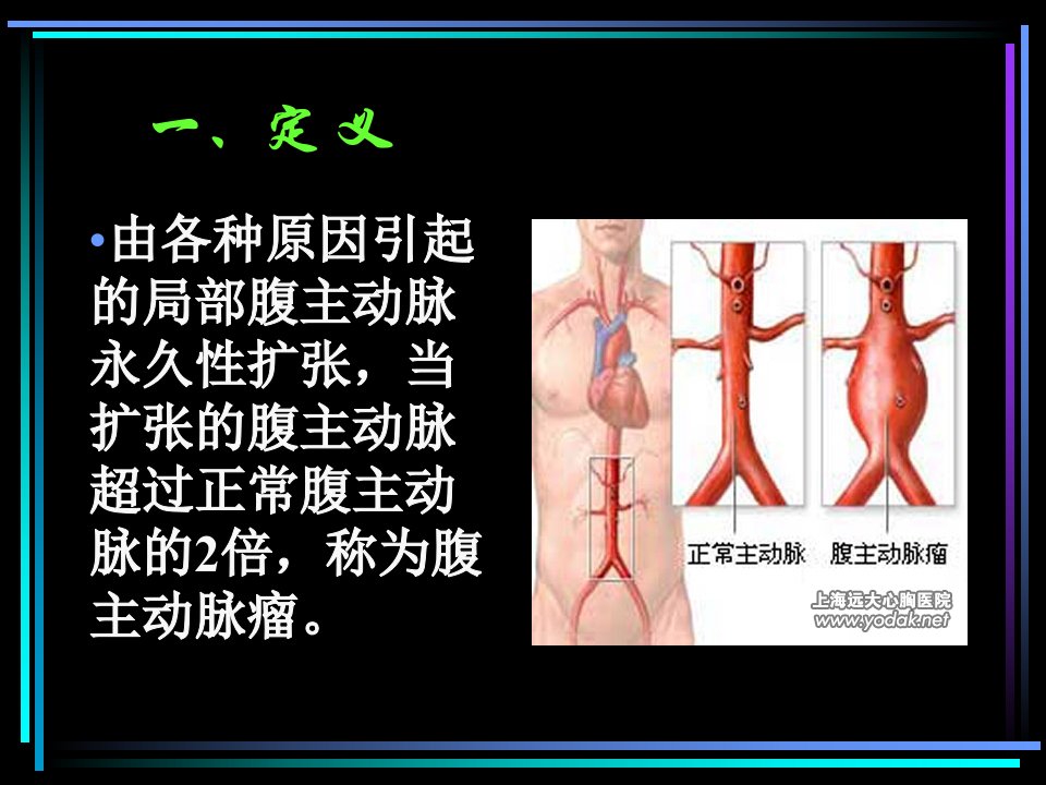 腹主动脉瘤课件医学PPT课件