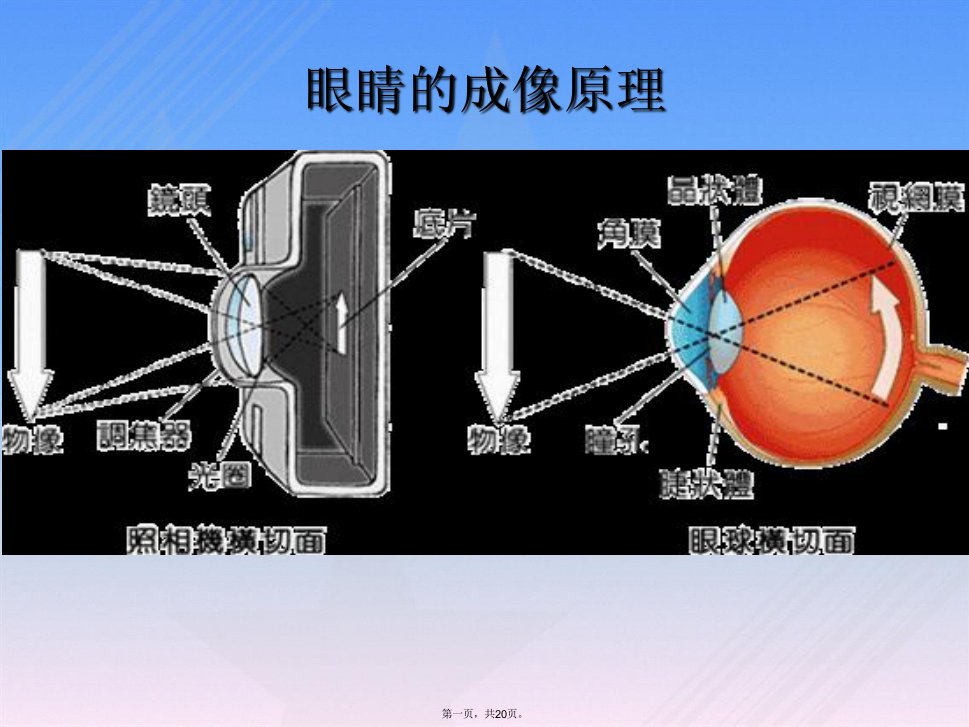 白内障健教课件