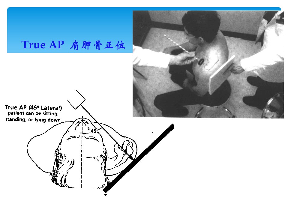 肩关节影像学及特殊检查汇编ppt课件