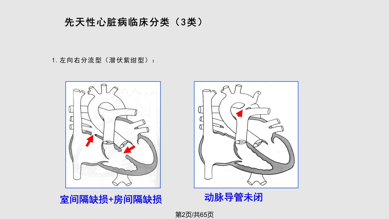 先心术后病人的循环治疗管理