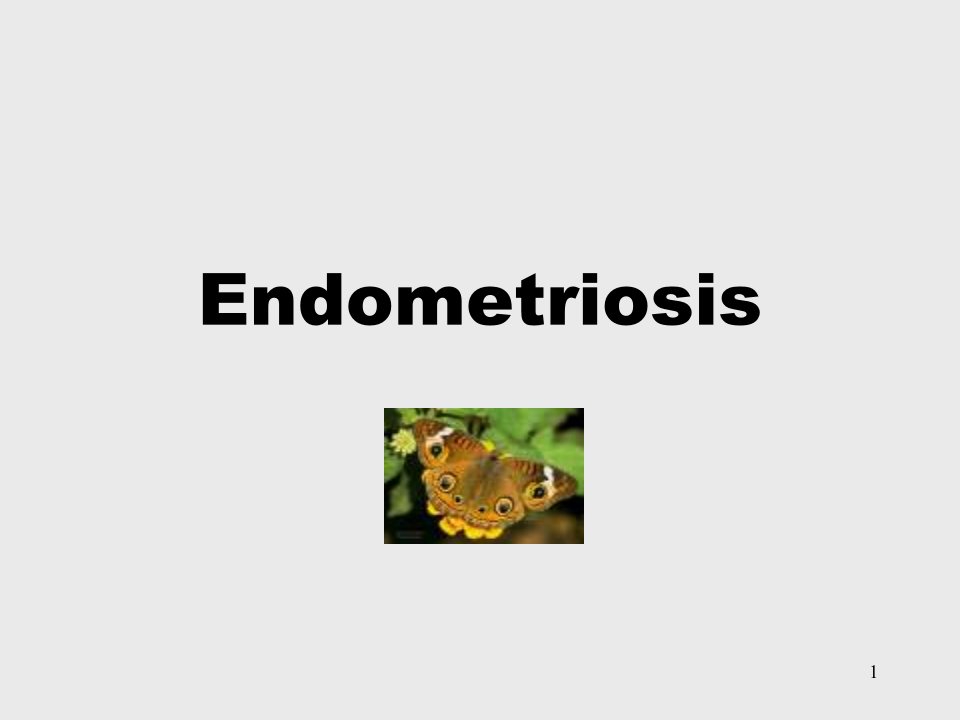 Endometriosis＆Adenomyosis上海交通大学医学院精…PPT45