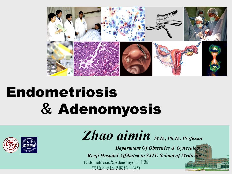 EndometriosisAdenomyosis上海交通大学医学院精45课件