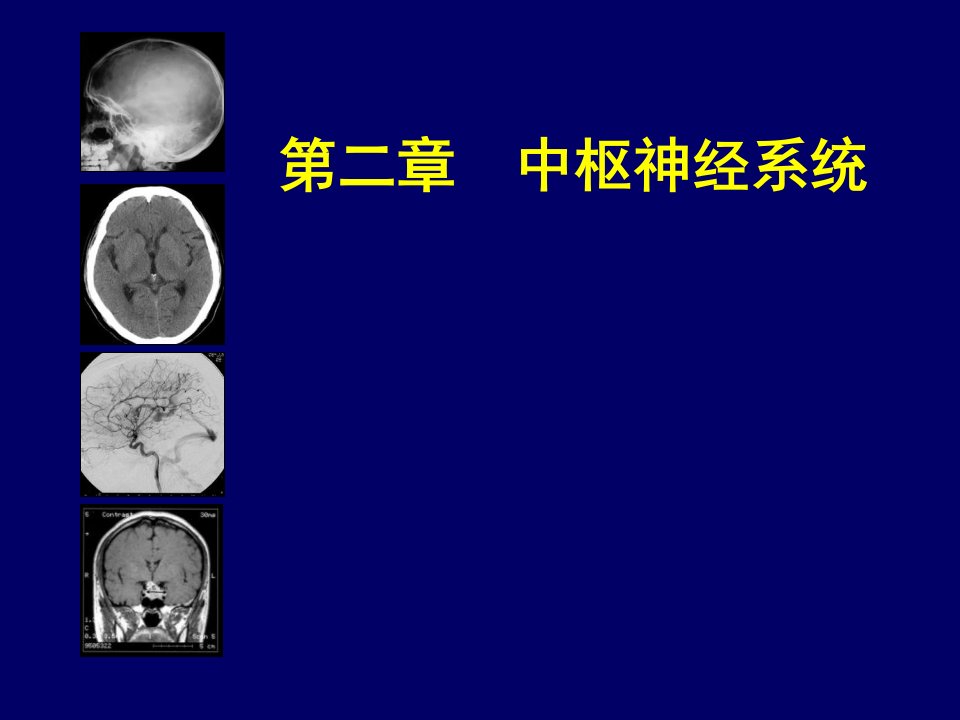 中枢神经系统影像学课件幻灯片