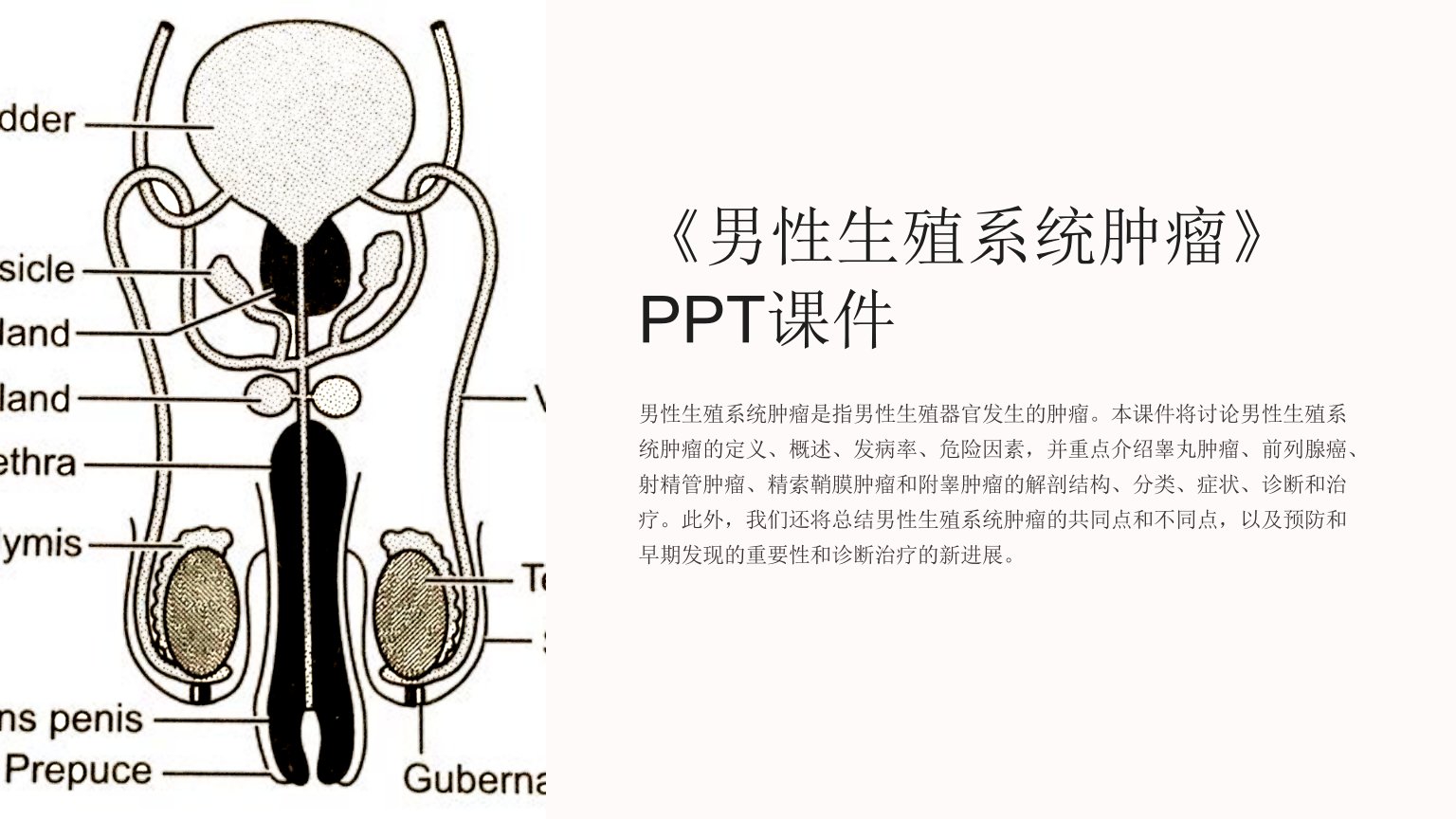 《男性生殖系统肿瘤》课件