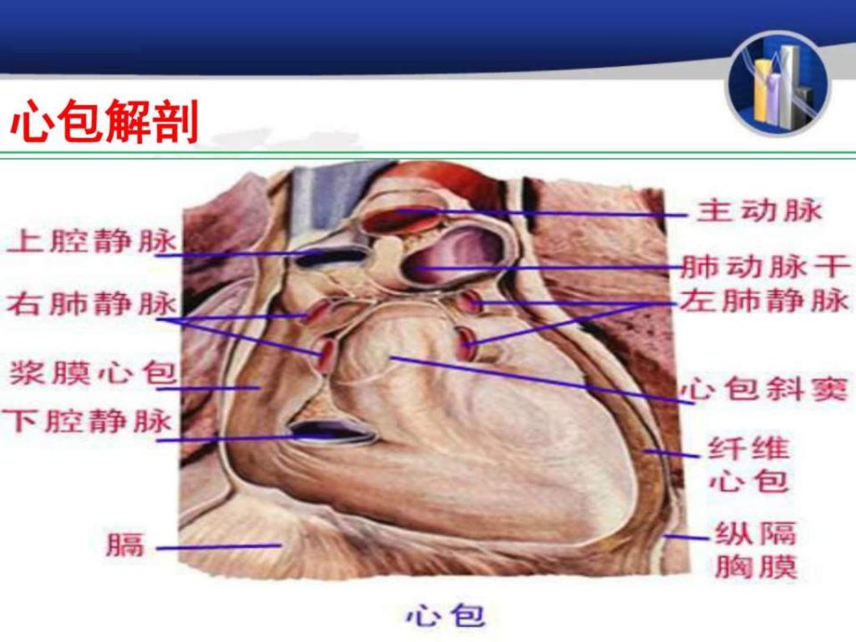 心包积液及心包填塞图文.pptPPT课件