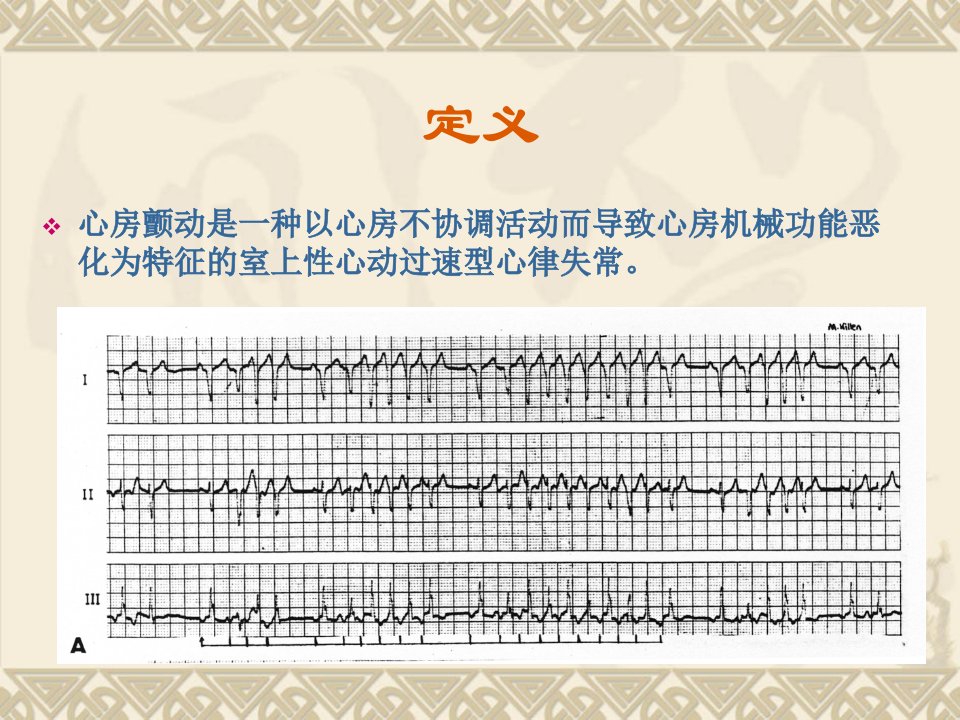 房颤的治疗策略ppt