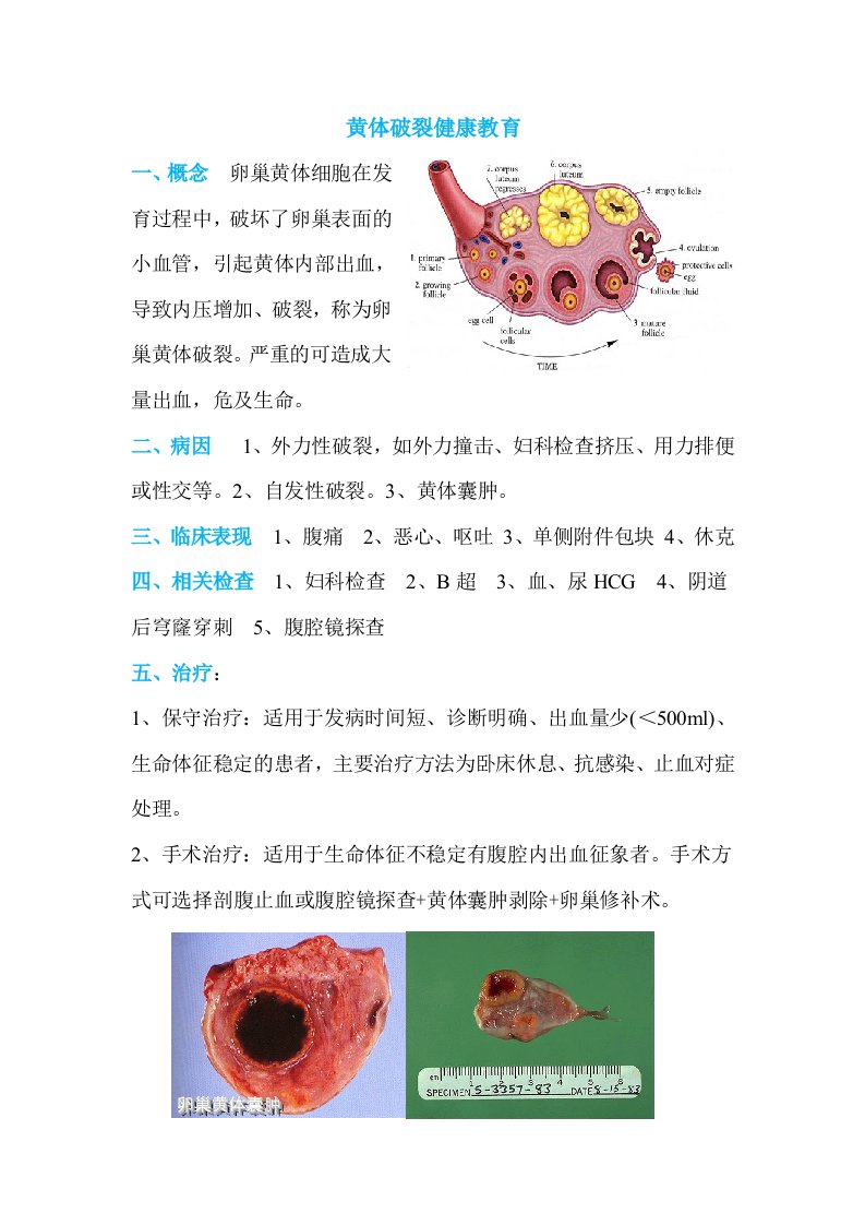 黄体破裂健康教育