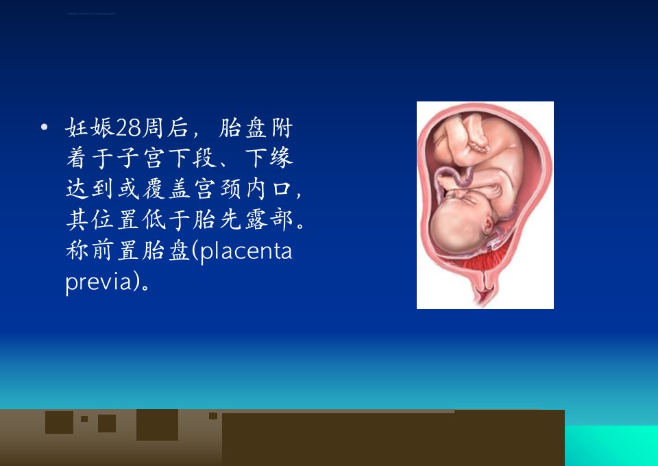 前置胎盘教学查房ppt课件