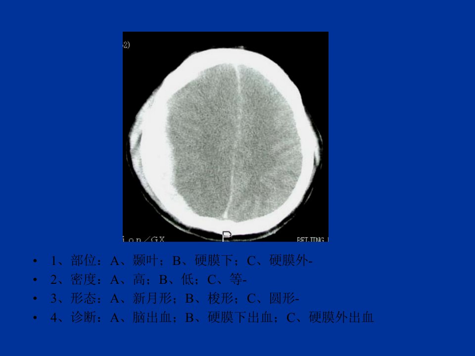 【医学课件大全】脑出血CT影像