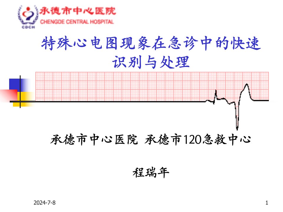 特殊心电图现象在急诊中的快速识别与处理