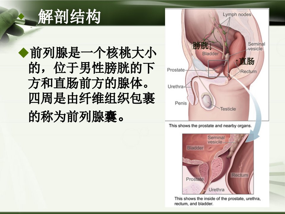 前列腺增生通用课件