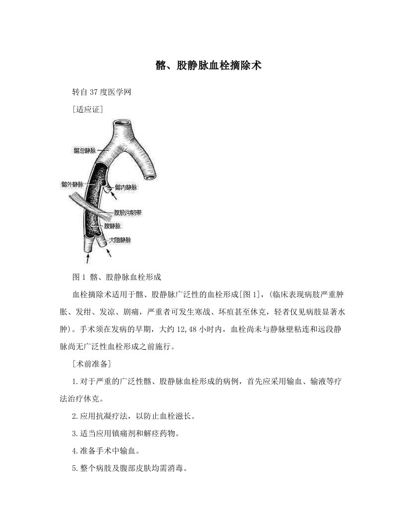 kwuAAA髂、股静脉血栓摘除术