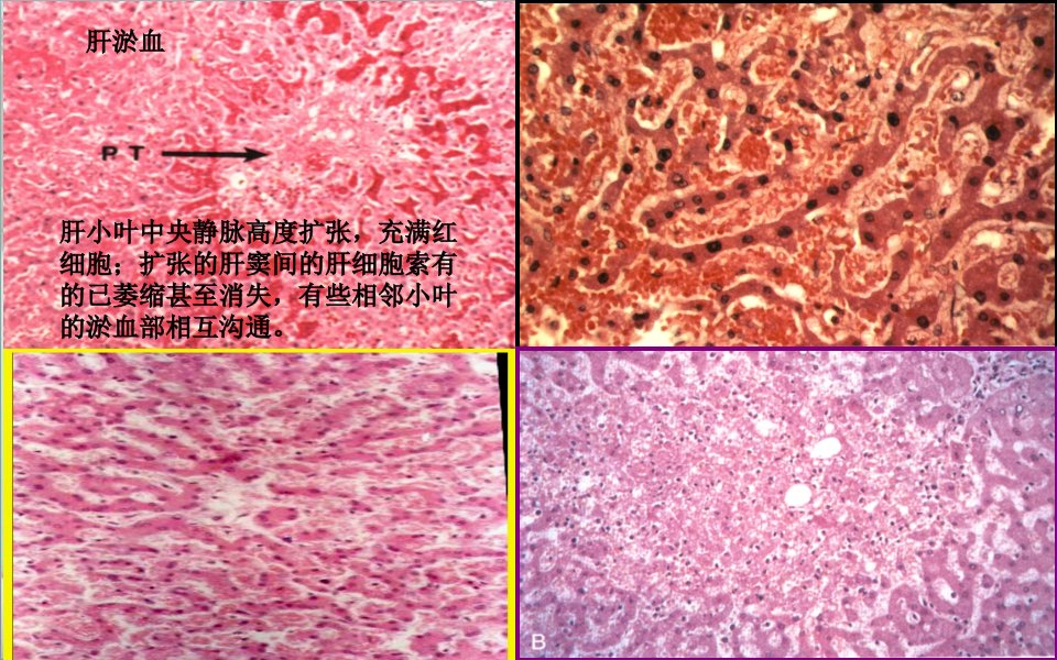 病理实验切片附说明