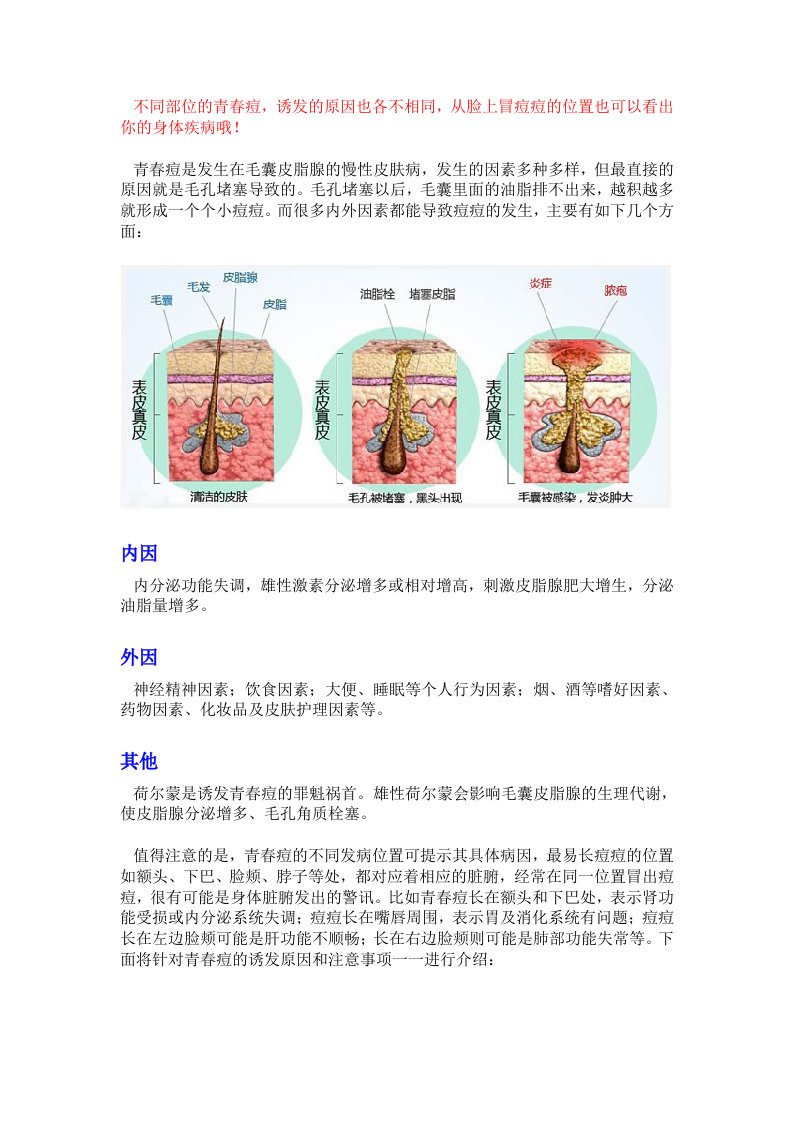 青春痘的位置与病因分析