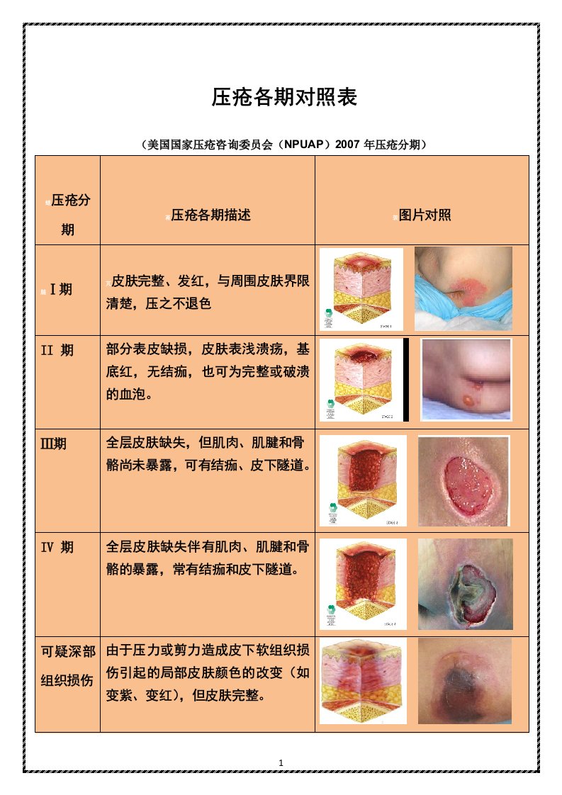 压疮各期对照表(彩图)