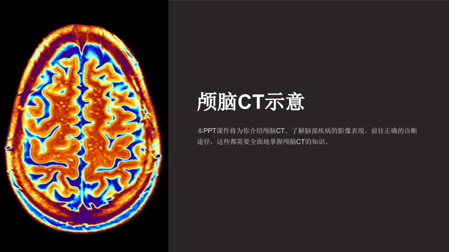 《颅脑CT示意》课件