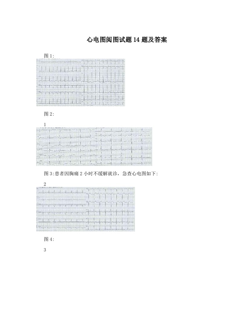 心电图阅图试题14题及答案