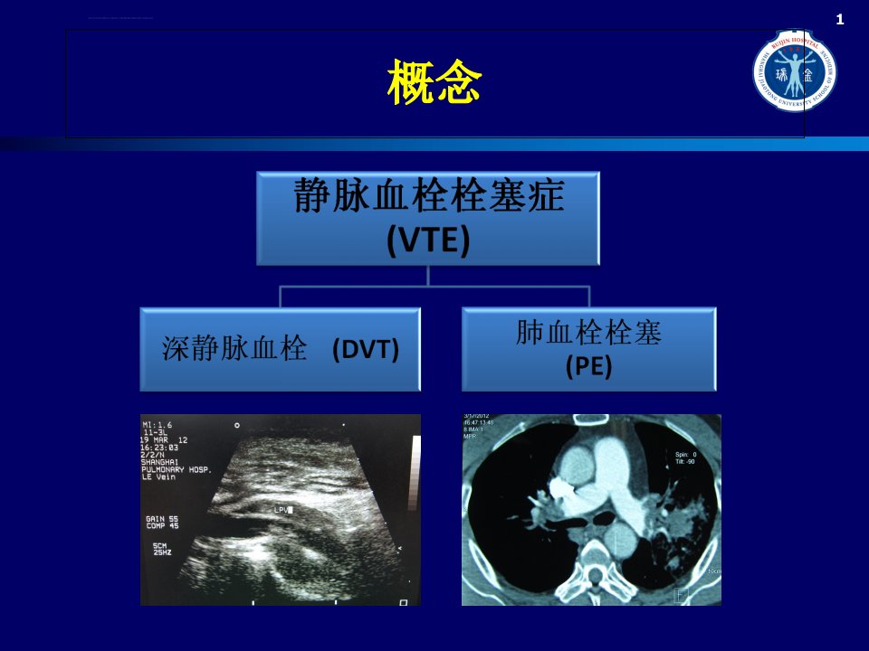 住院患者的VTE风险和防治ppt课件