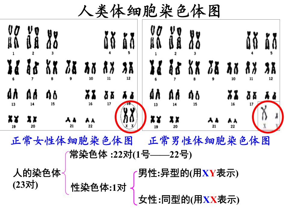 医学专题抗维生素D佝偻病是伴X显性遗传病