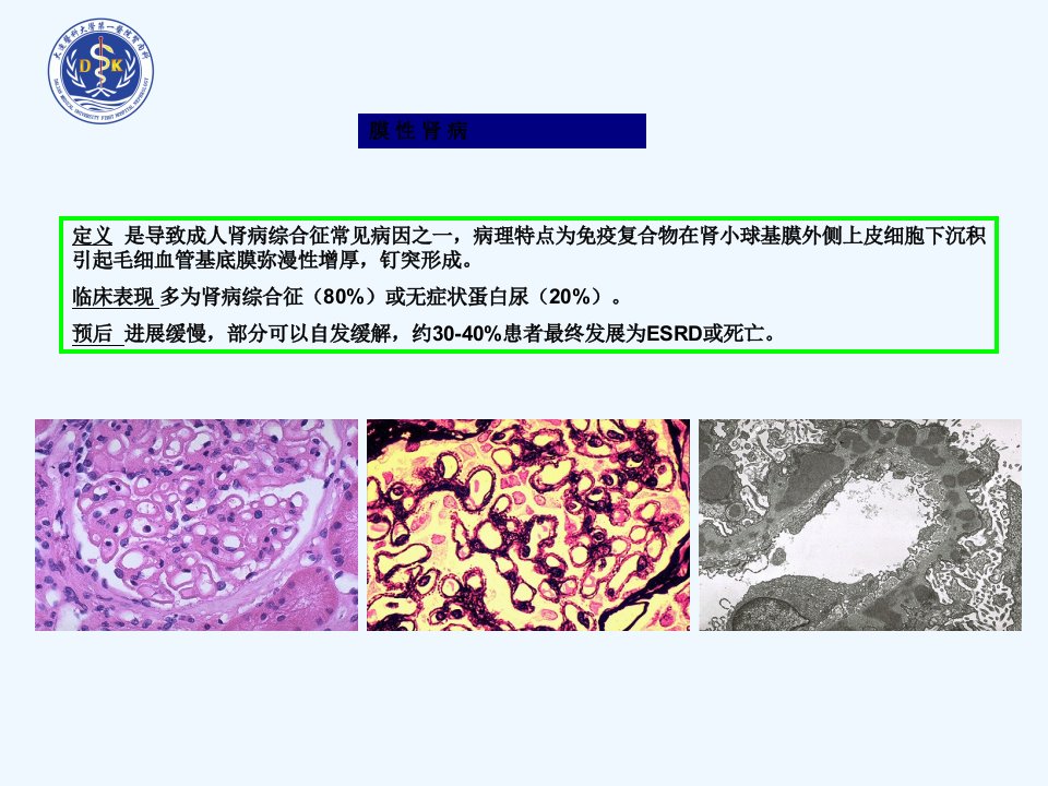 KDIQO指南解读膜性肾病治疗