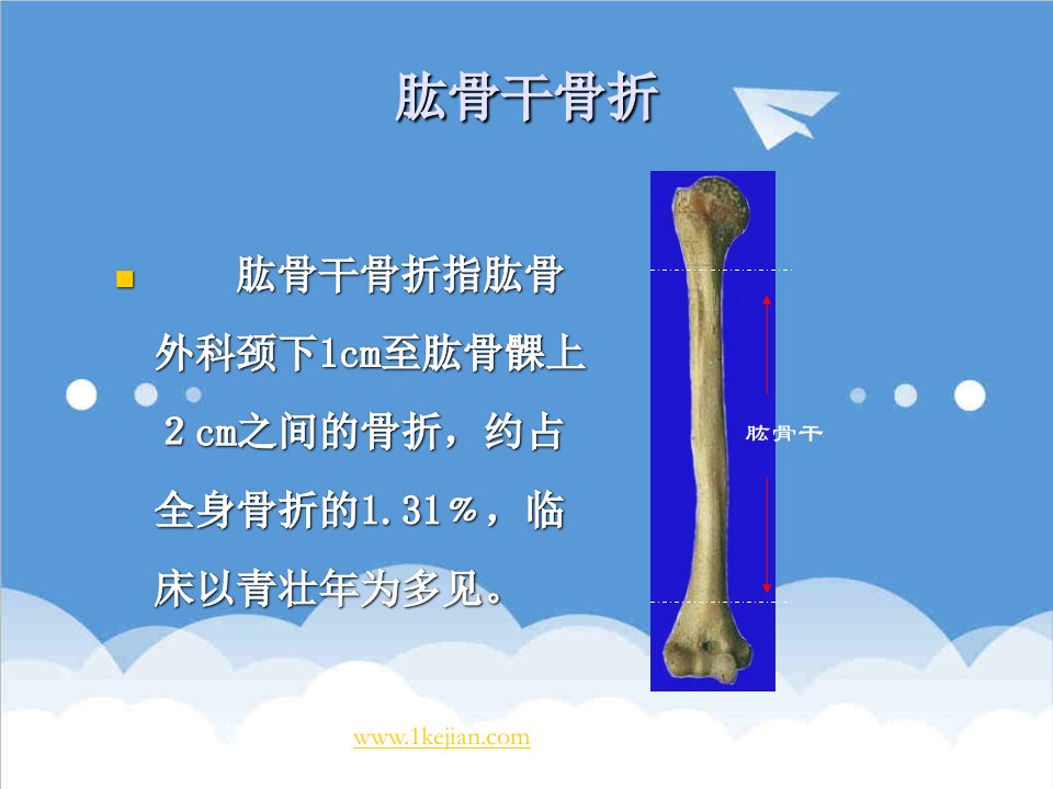 肱骨干骨折