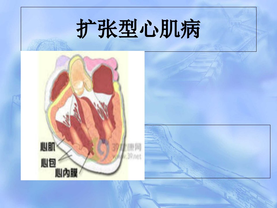 扩张型心肌病查房