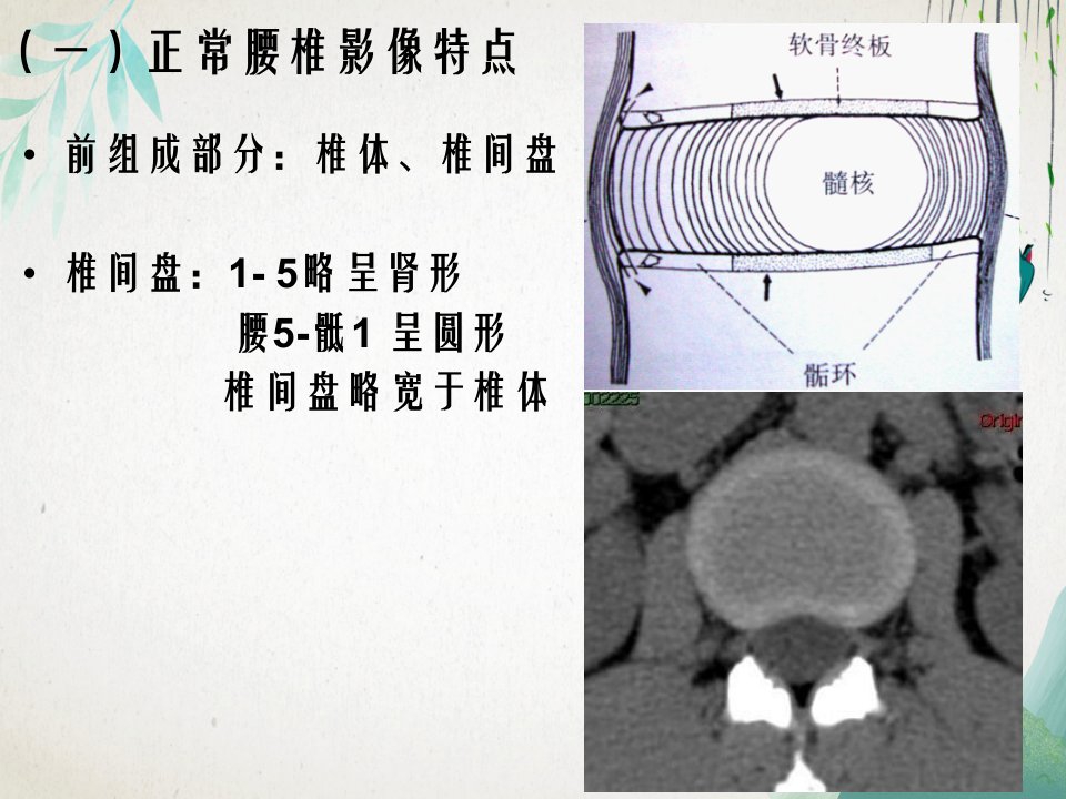 腰椎管狭窄症状