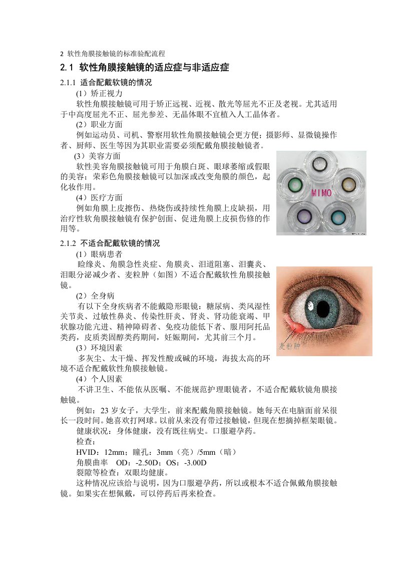 软性角膜接触镜的标准验配流程