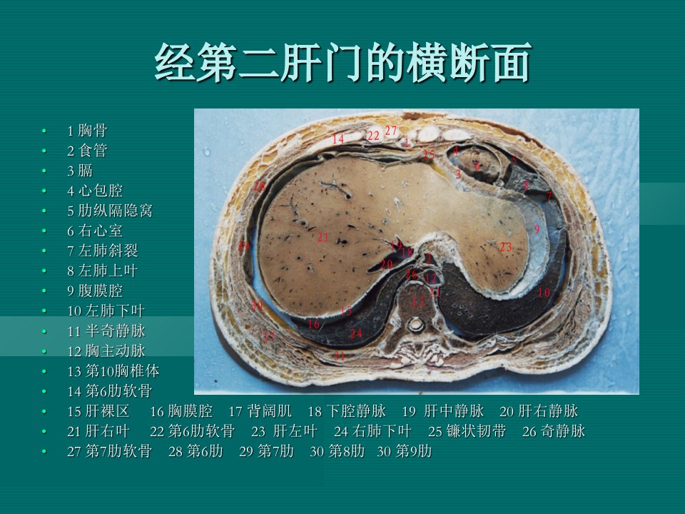 经肝门的横断面昆明医学院上课讲义