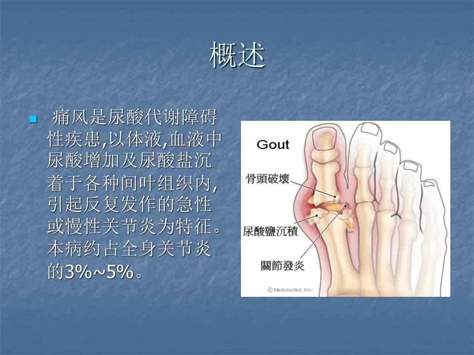 痛风性关节炎ppt课件