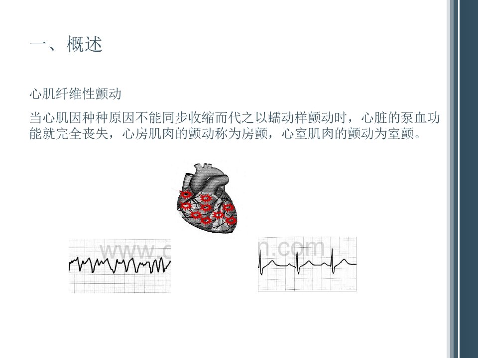 除颤仪的原理及质量控制