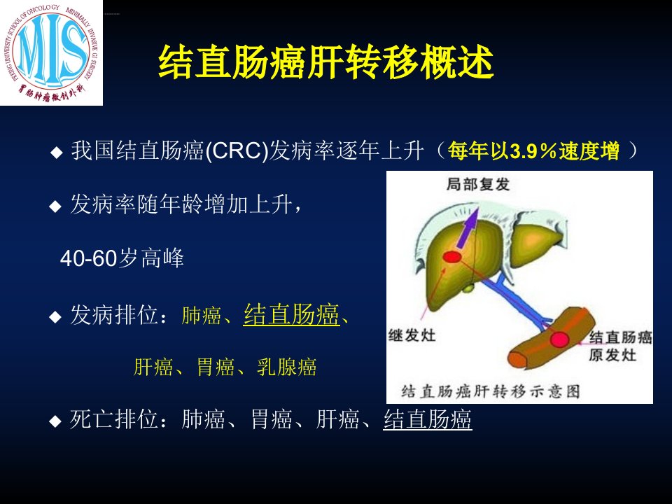 结直肠癌肝转移外科治疗ppt课件