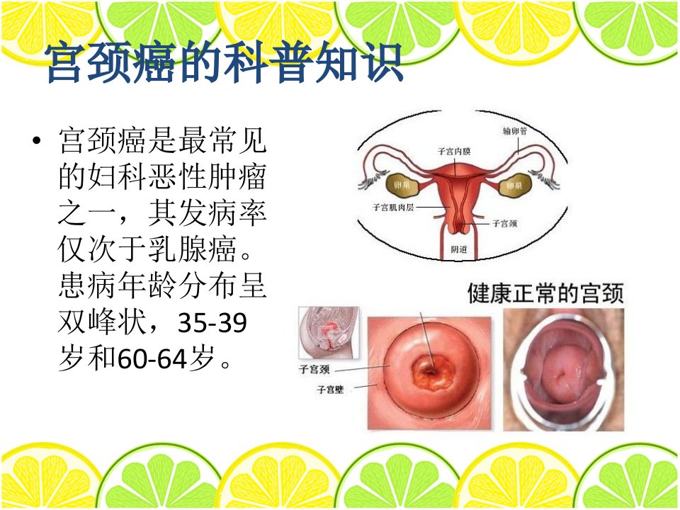 宫颈癌广泛性子宫切除盆腔淋巴结清扫手术配合ppt课件