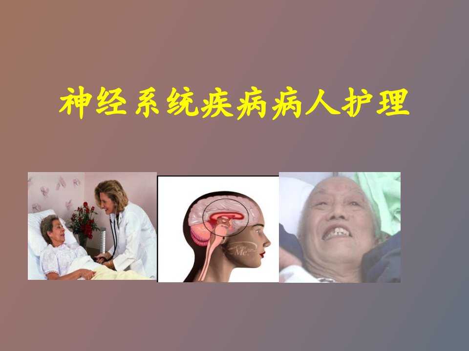 神经系统疾病病人护理