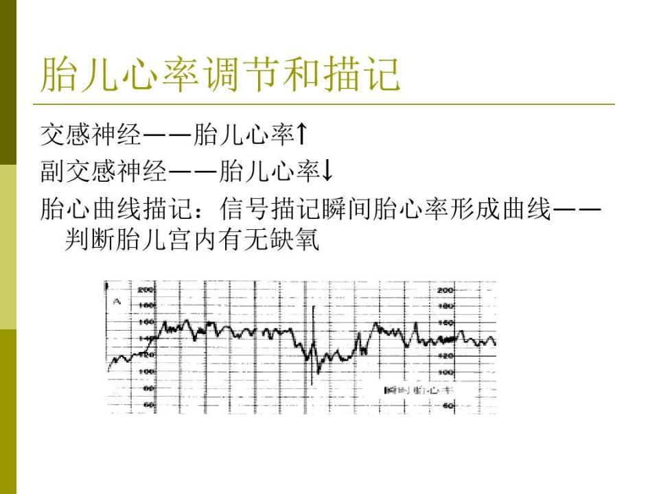 胎心监护及判读说课材料课件