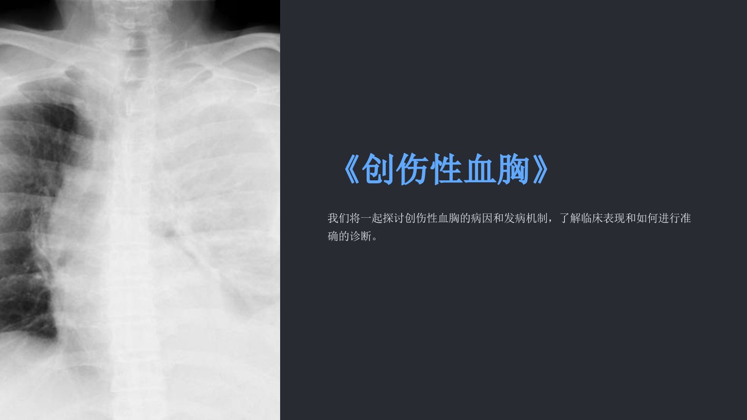 《创伤性血胸》课件