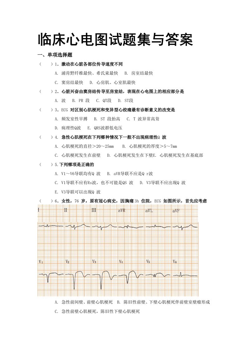 临床心电图试题集与答案