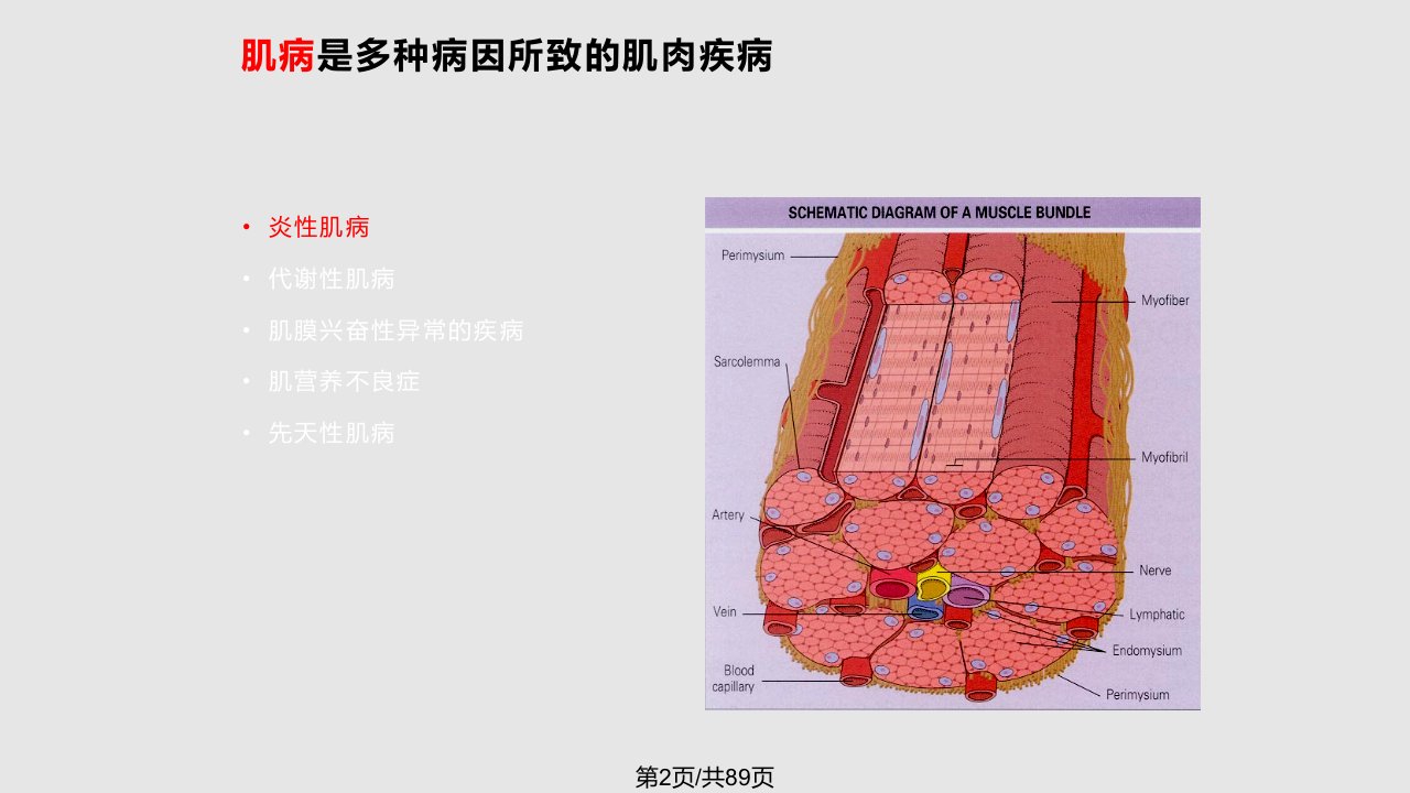 特发性炎症性肌病