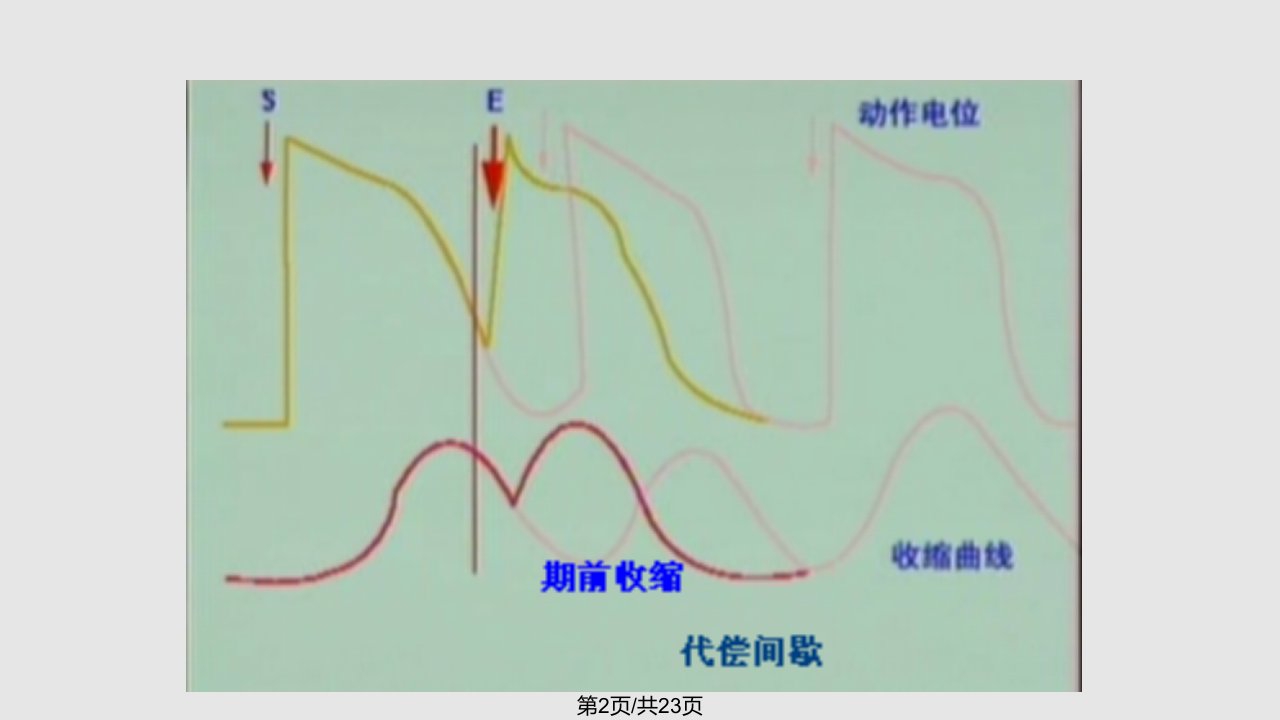 期前收缩和代偿间歇蛙心灌流