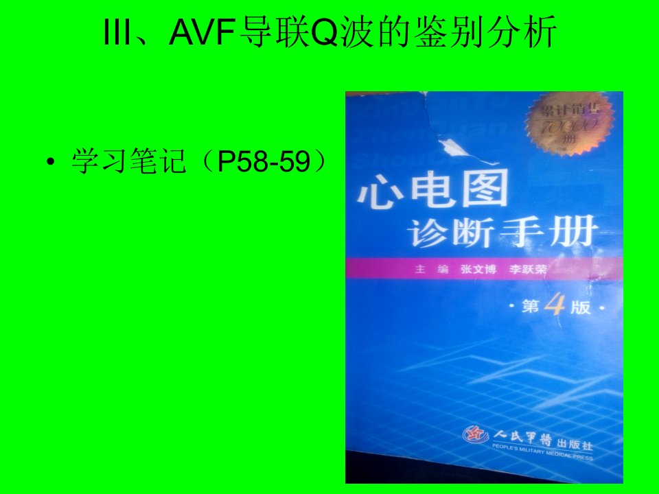 下壁病理性Q波看AVR导联