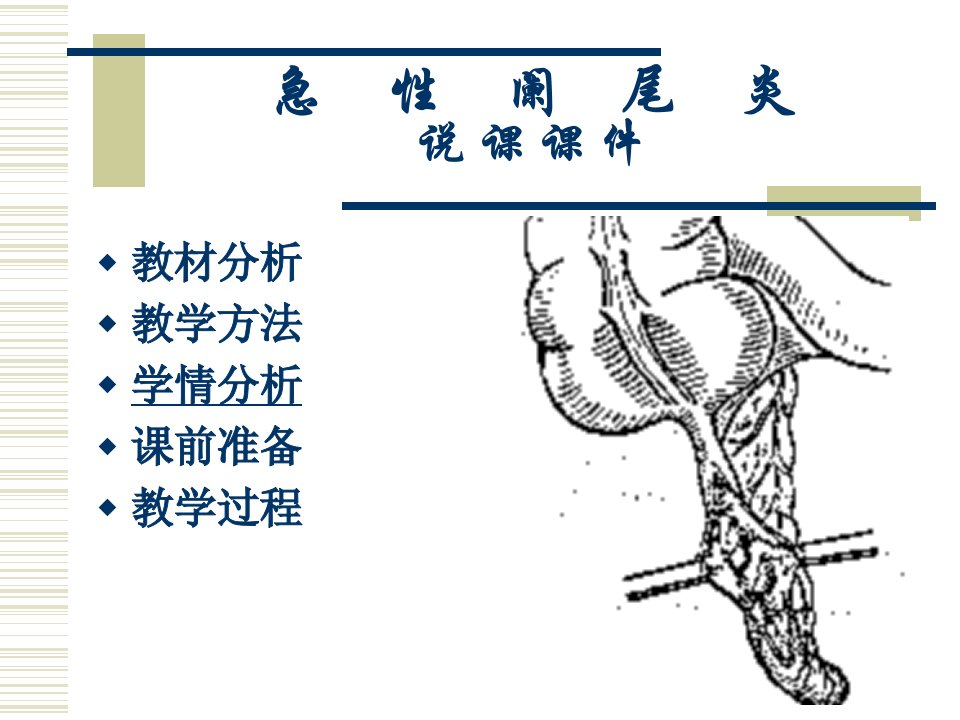 急性阑尾炎说课课件同名1