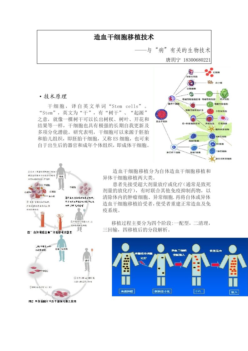 造血干细胞移植技术