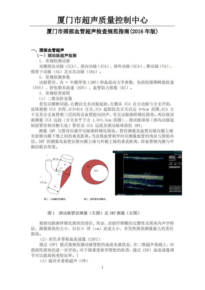 颈部血管超声检查规范指南