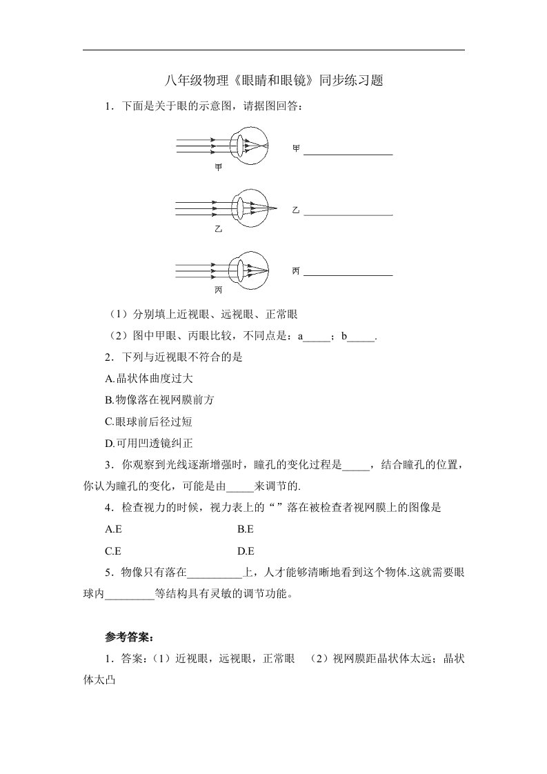 八年级物理上《眼睛和眼镜》同步练习题