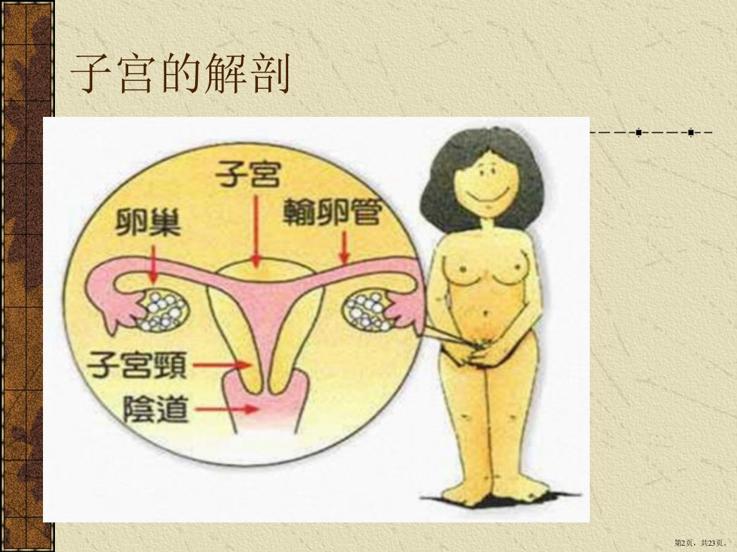 腹腔镜下子宫全切的术中配合及护理课件PPT23页